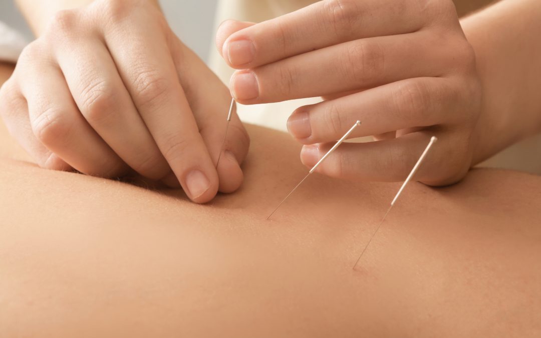 How Dry Needling Continuing Education Texas Empowers Physical Therapists to Expand Skills