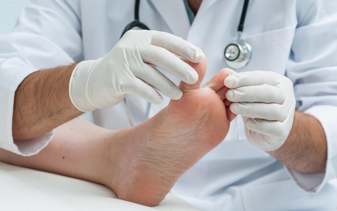 Simple Habits for Healthier Living with Diabetic Foot Care in Abingdon, M