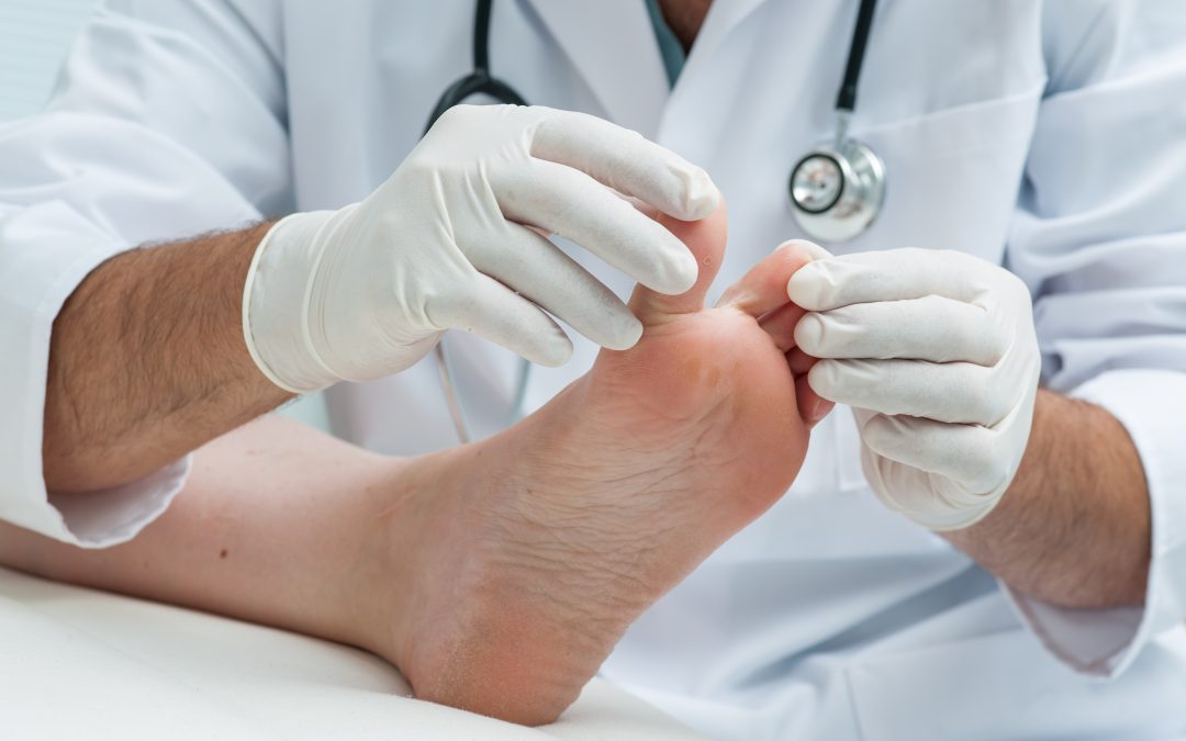 Effective Home Remedies Before Trying Heel Pain Treatment Cypress TX Offers